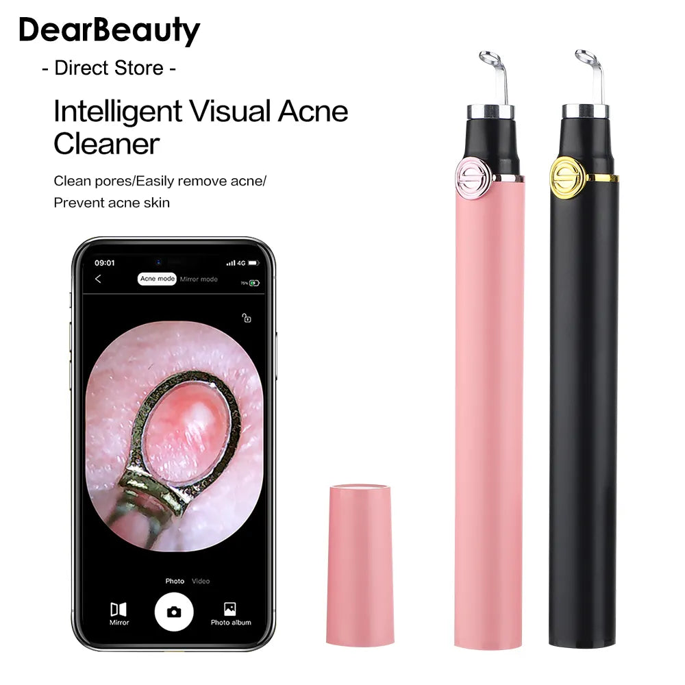 Smart Visual Acne/ Blackhead Remover