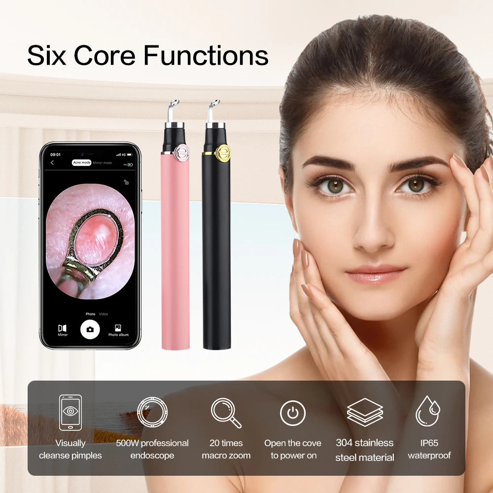 Smart Visual Acne/ Blackhead Remover