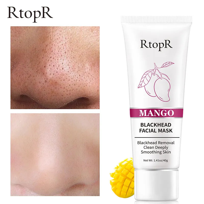 RtopR Mango Facial Blackhead Remover