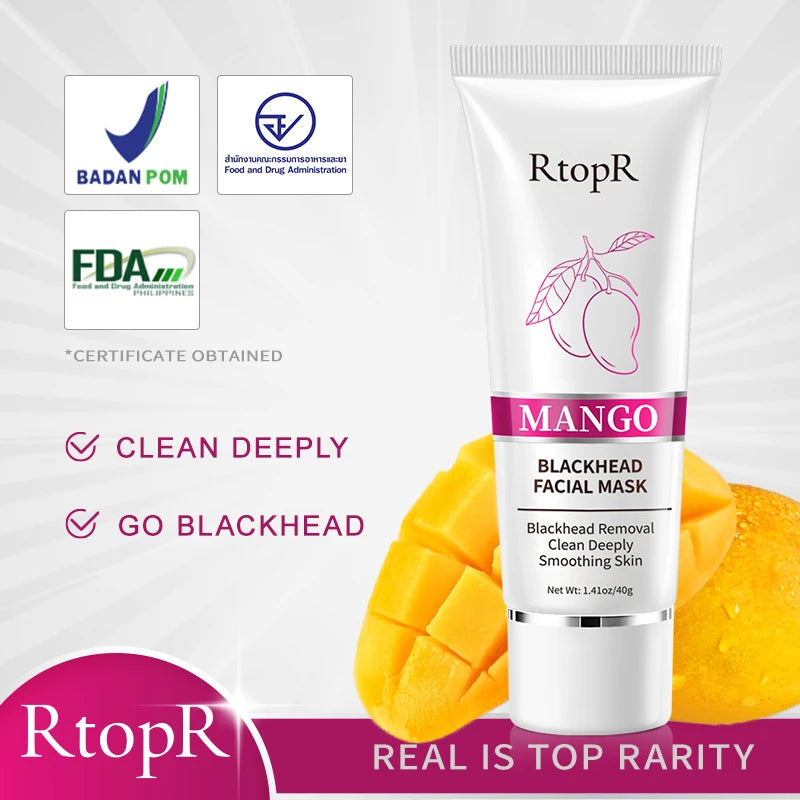 RtopR Mango Facial Blackhead Remover