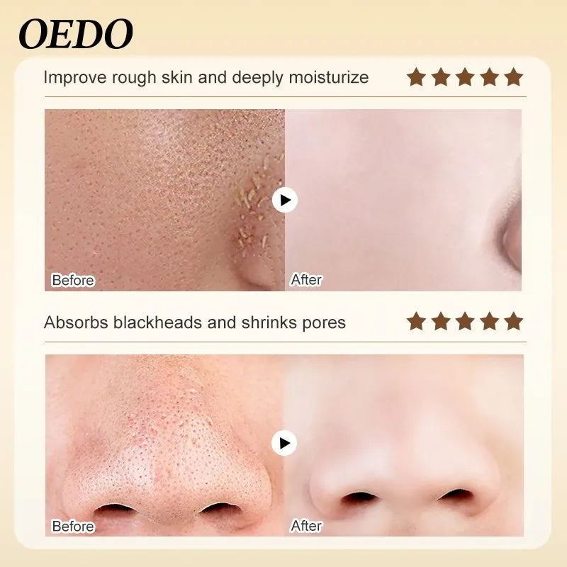 Clean Blackhead Mask Removing Blackhead Acne Skin Rejuvenation Anti-aging Whitening Moisturizing Deep Cleansing Pore Face Care