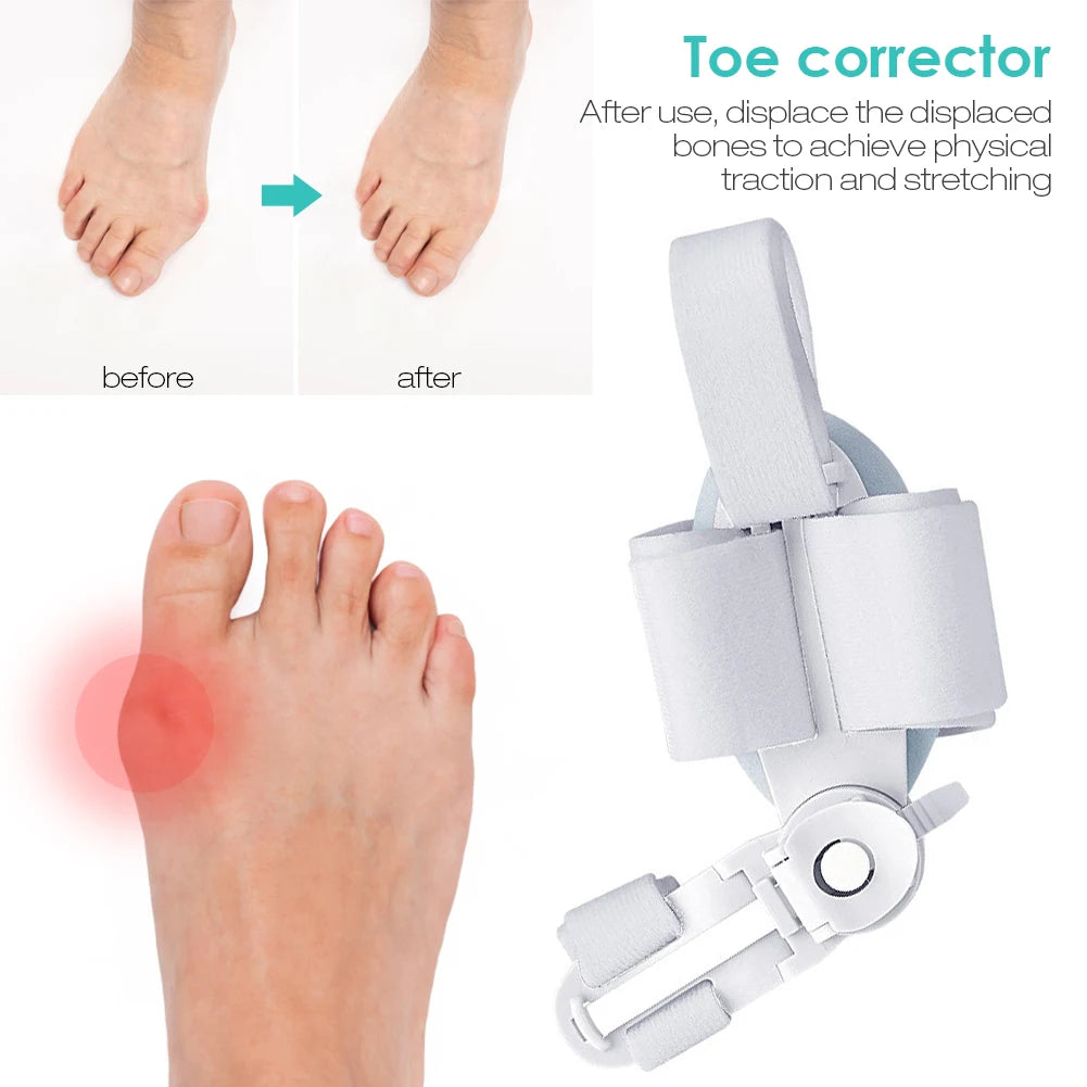 1/2PCS Thumb Corrector Hallux Valgus Bunion Foot