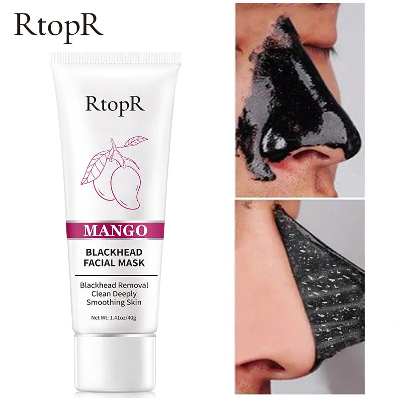 RtopR Mango Facial Blackhead Remover